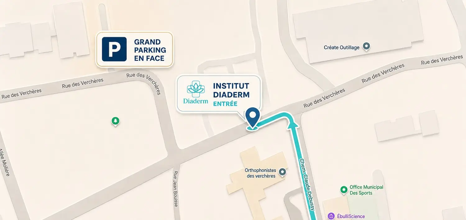 Plan d’accès à l’Institut Diaderm — Grand parking en face, entrée Chemin Claude Debussy, 69120 Vaulx-en-Velin